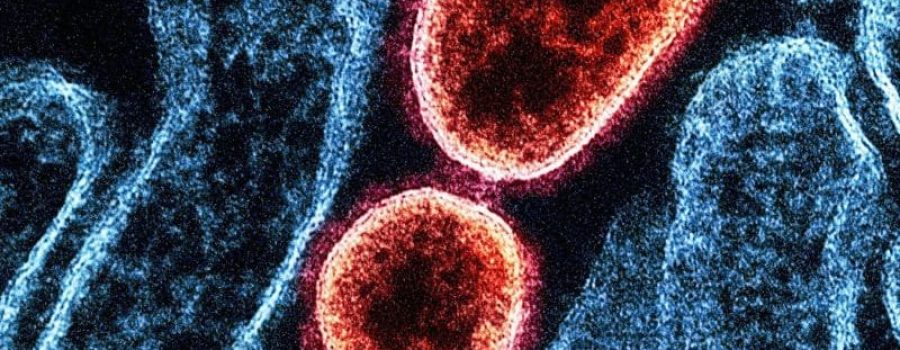 Compra tu estudio de microbiota y disbiosis oral, en VIVOLABS.