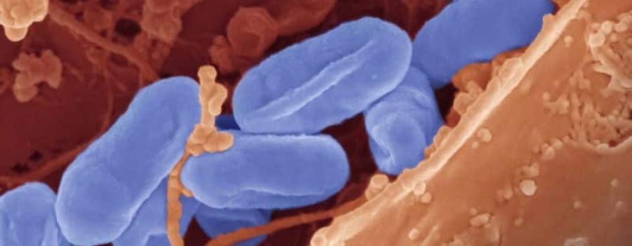 Compra tu estudio esencial de microbiota y disbiosis.