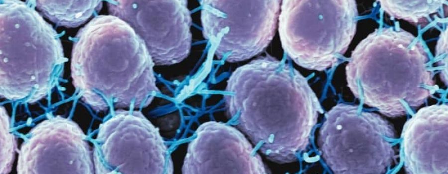 Compra tu estudio para infecciones y bacterias potencialmente malignas, en VIVOLABS.