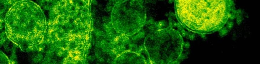 Estudio de parasitoma intestinal en VIVOLABS.