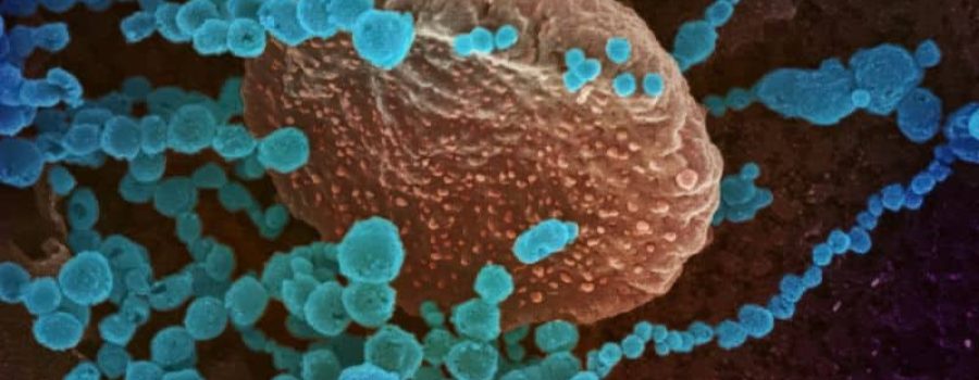 Compra tu estudio de parasitoma, en VIVOLABS.