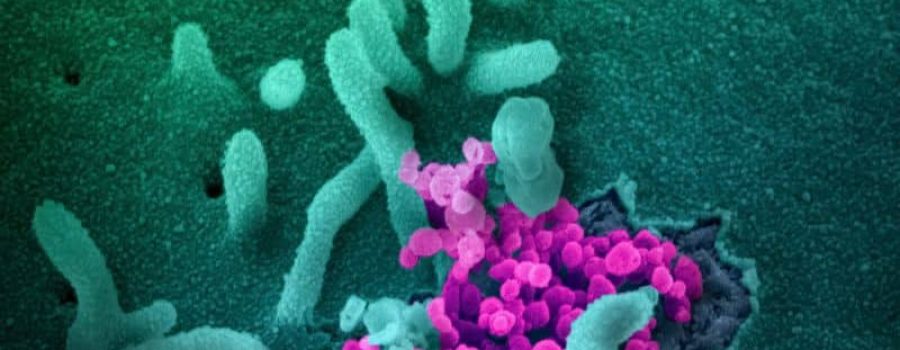 Compra tu estudio de sobrecrecimiento fúngico intestinal (SIFO), al mejor precio.