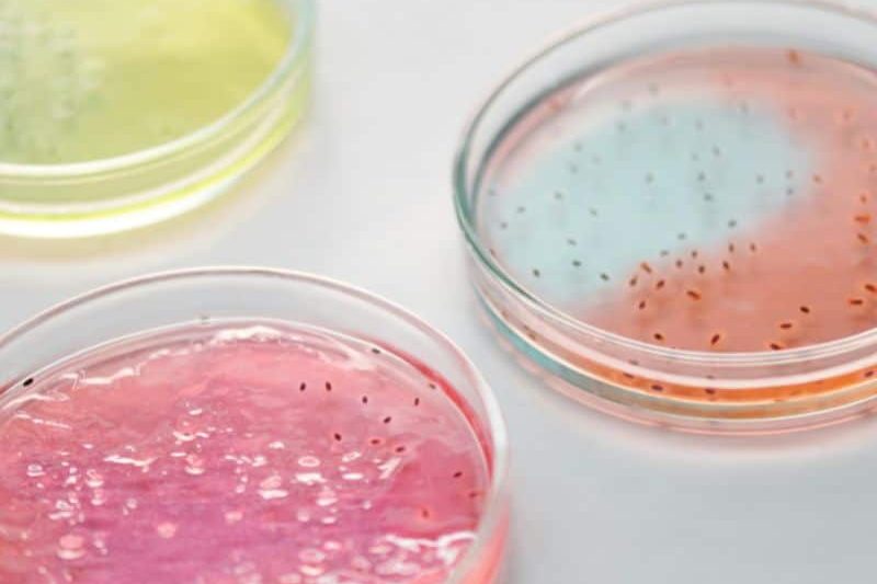 prueba-avanzada-microbiota