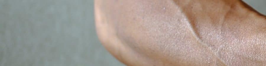 Una prueba para estimar el riesgo cardiovascular.