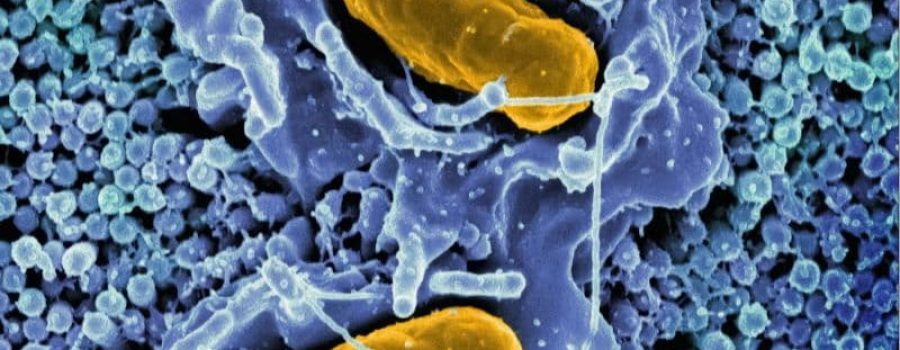 Compra tu test de aliento para la detección de Helicobacter pylori, al mejor precio.