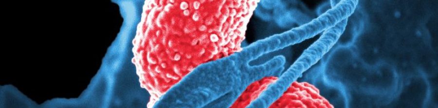 Test de aliento para el sobrecrecimiento bacteriano del intestino delgado (SIBO).