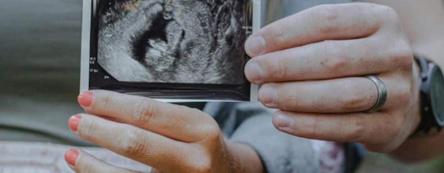 Compra tu test de compatibilidad inmunológica padre-madre-feto, con VIVOLABS.